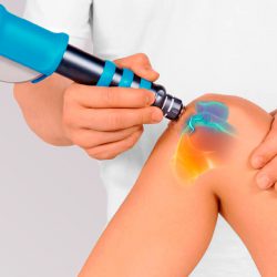 Ударно-волновая терапия суставов